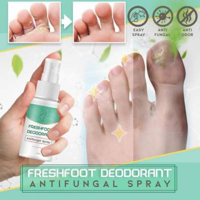 fresh foot deodorant ant fungus spry 30ml